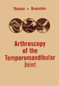 Arthroscopy of the Temporomandibular Joint,Used