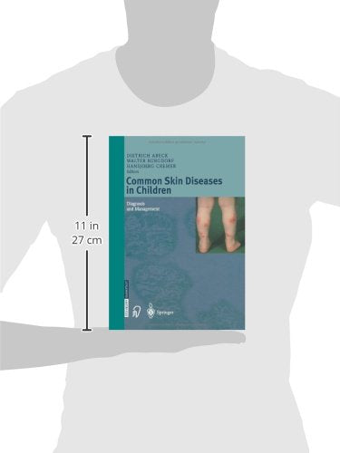 Common Skin Diseases in Children: Diagnosis and Management,Used