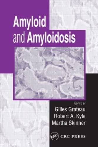 Amyloid and Amyloidosis,Used