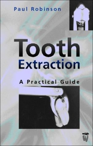 Tooth Extraction: A Practical Guide,Used
