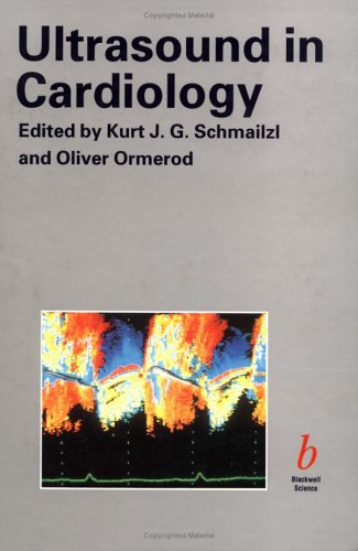 Ultrasound In Cardiology,Used