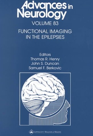Functional Imaging in the Epilepsies,Used