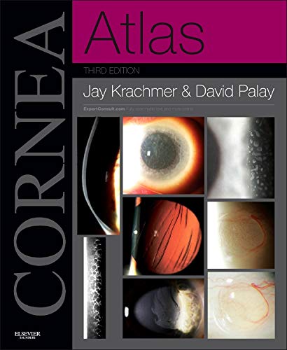 Cornea Atlas: Expert Consult Online and Print, 3e,Used