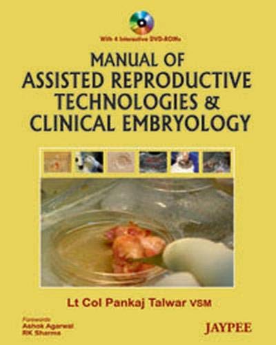 Manual of Assisted Reproductive Technologies and Clinical Embryology,Used