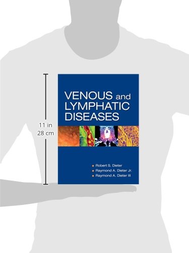 Venous And Lymphatic Diseases,Used
