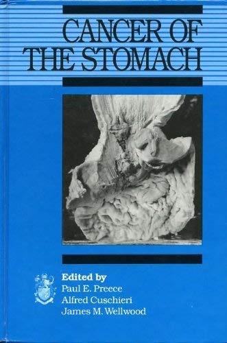 Cancer of the Stomach,Used