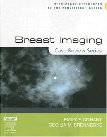 Breast Imaging: Case Review Series