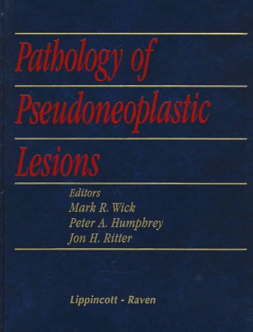 Pathology of Pseudoneoplastic Lesions,Used