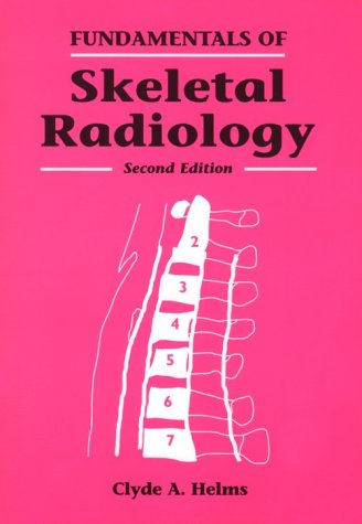 Fundamentals of Skeletal Radiology,Used
