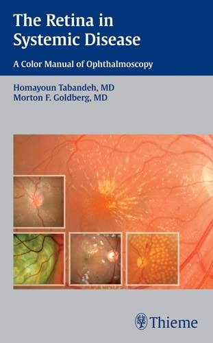 The Retina in Systemic Disease: A Color Manual of Ophthalmoscopy,Used