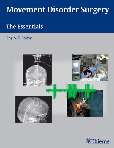 Movement Disorder Surgery: The Essentials,New