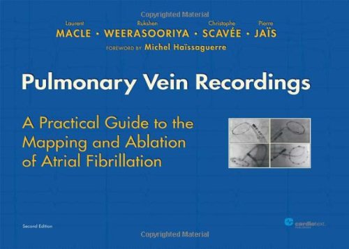 Pulmonary Vein Recordings: A Practical Guide To The Mapping And Ablation Of Atrial Fibrillation-new,New