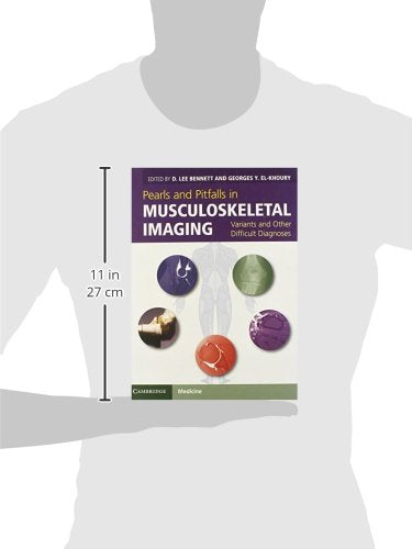 Pearls and Pitfalls in Musculoskeletal Imaging: Variants and Other Difficult Diagnoses,Used