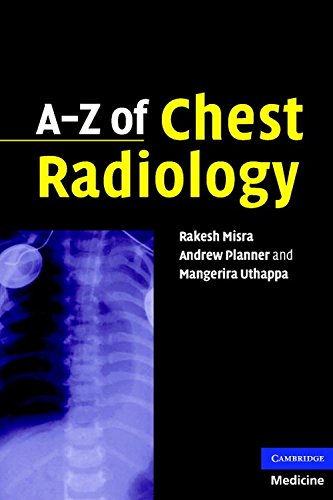 AZ of Chest Radiology,Used