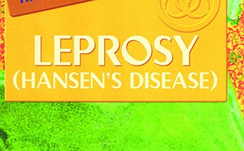 Leprosy (Hansen's Disease) (Epidemics),Used