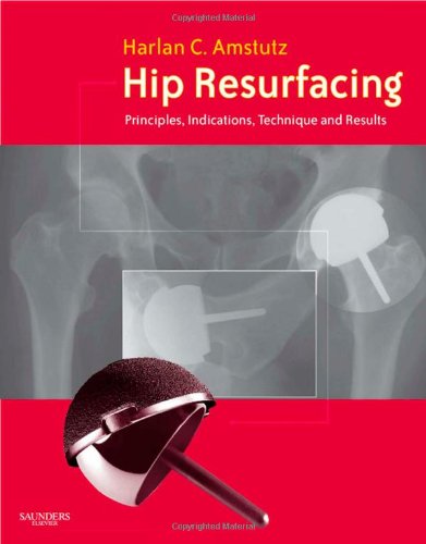 Hip Resurfacing: Principles, Indications, Technique and Results Book and DVD,Used