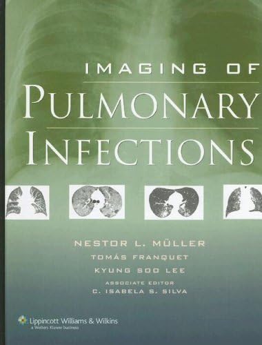 Imaging of Pulmonary Infections,Used