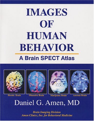 Images of Human Behavior: A Brain SPECT Atlas,Used