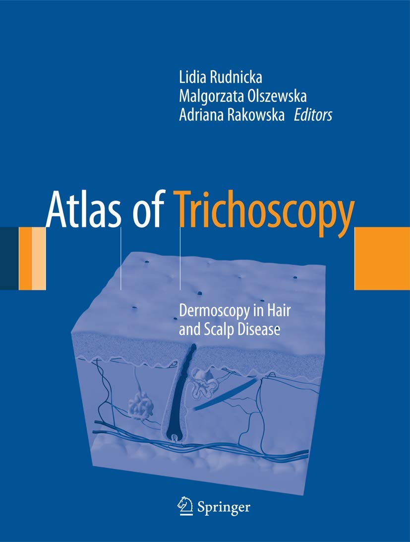 Atlas of Trichoscopy: Dermoscopy in Hair and Scalp Disease,Used