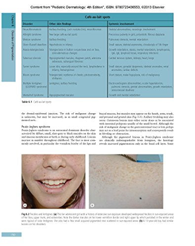 Pediatric Dermatology: Expert Consult  Online and Print (Cohen, Pediatric Dermatology),Used