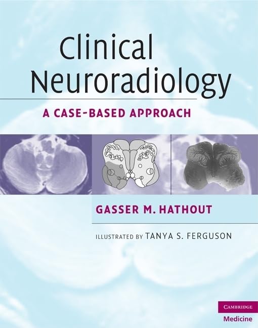 Clinical Neuroradiology: A CaseBased Approach (Cambridge Medicine (Hardcover)),New