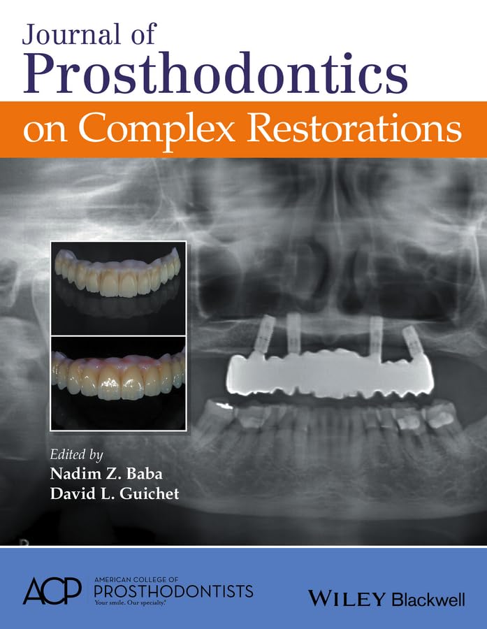 Journal of Prosthodontics on Complex Restorations,Used