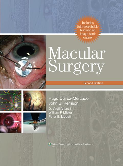 Macular Surgery,Used