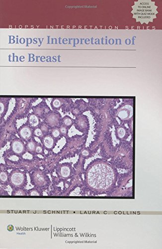 Biopsy Interpretation Of The Breast,Used