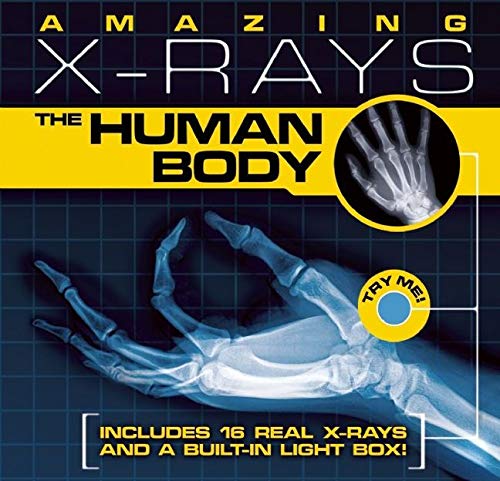 Amazing Xrays: The Human Body