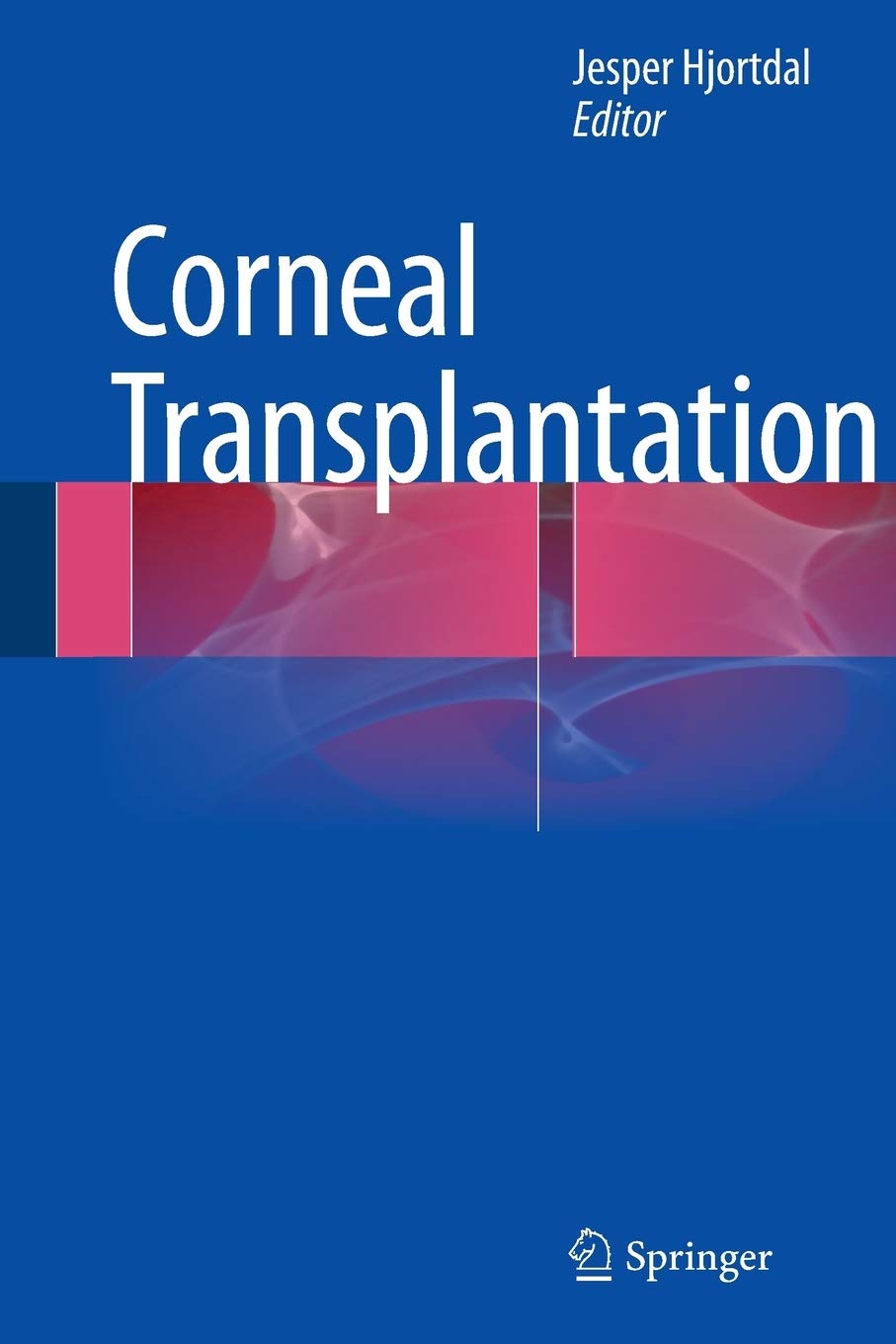Corneal Transplantation,Used