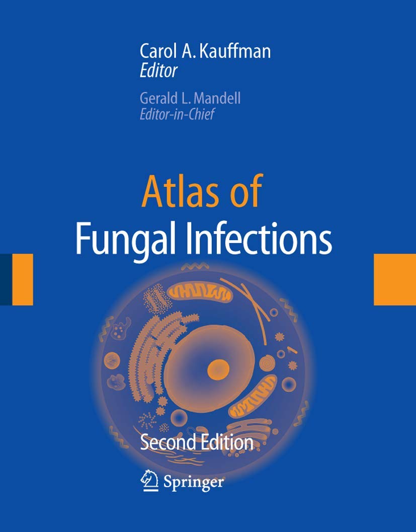 Atlas of Fungal Infection,Used