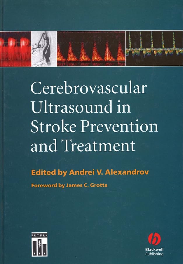 Cerebrovascular Ultrasound in Stroke Prevention and Treatment,Used