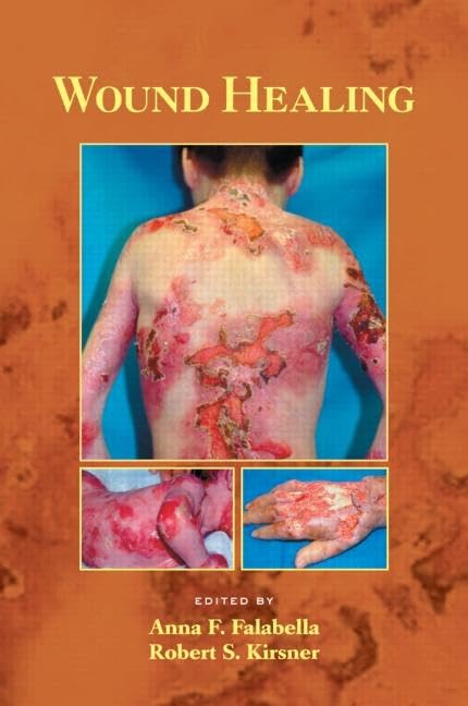 Wound Healing (Basic and Clinical Dermatology, 33),Used