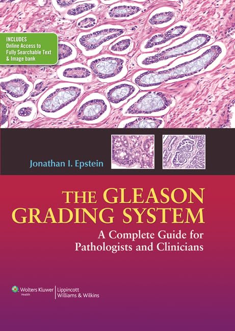 The Gleason Grading System: A Complete Guide for Pathologist and Clinicians,Used