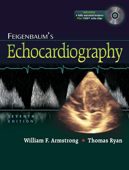Feigenbaum's Echocardiography,Used