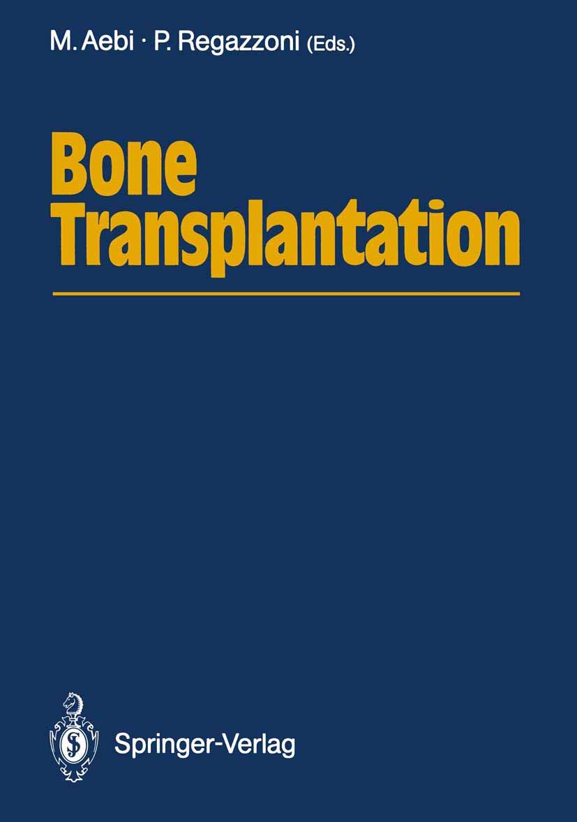 Bone Transplantation,Used