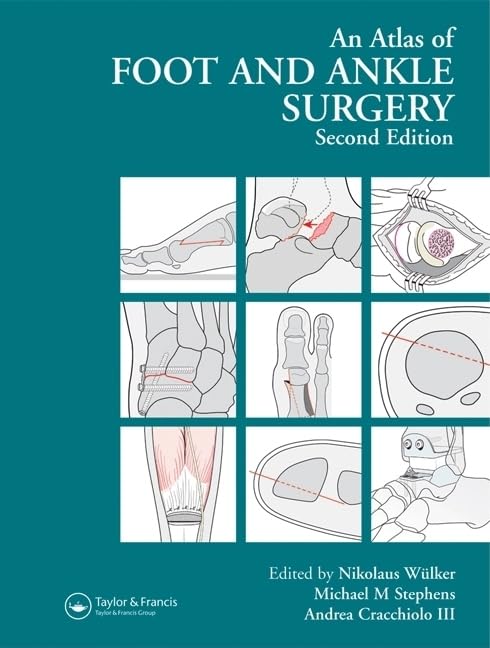 Atlas Foot and Ankle Surgery,Used