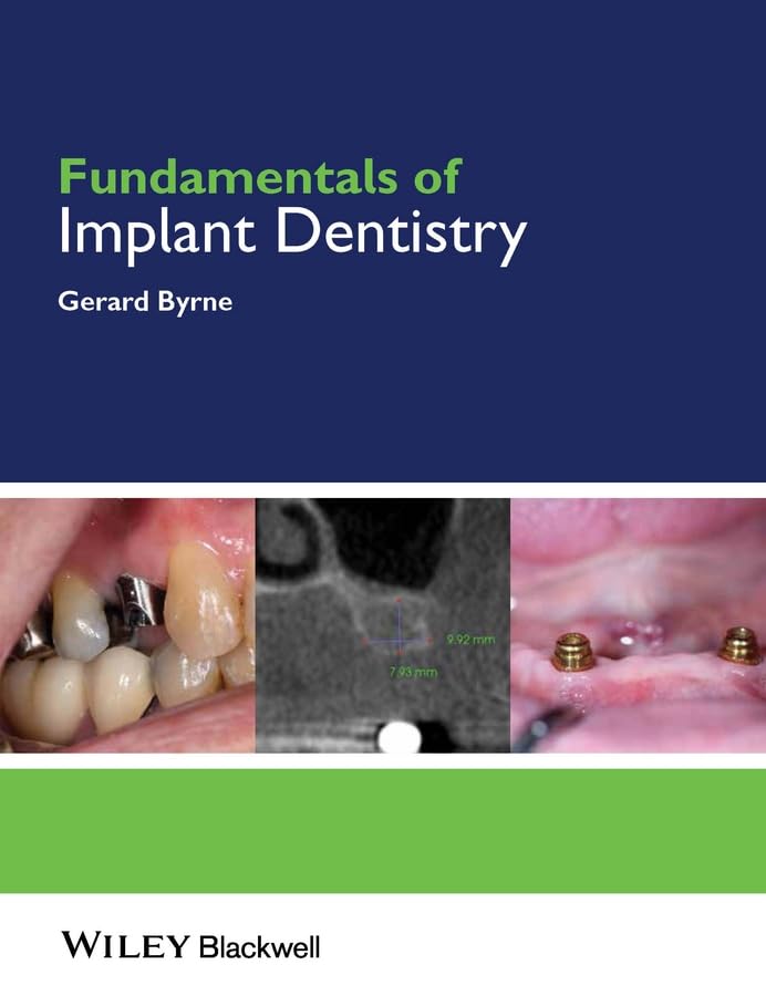 Fundamentals Of Implant Dentistry