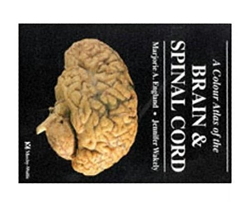 A Colour Atlas of The Brain and Spinal Cord,New