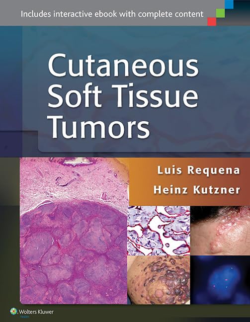 Cutaneous Soft Tissue Tumors,Used