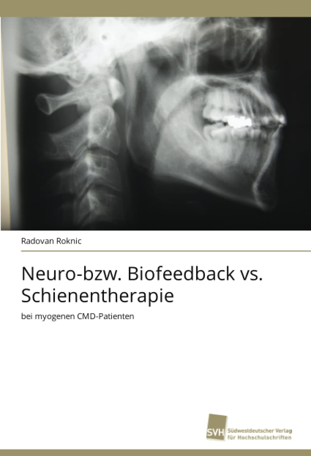 Neurobzw. Biofeedback vs. Schienentherapie: bei myogenen CMDPatienten (German Edition),Used