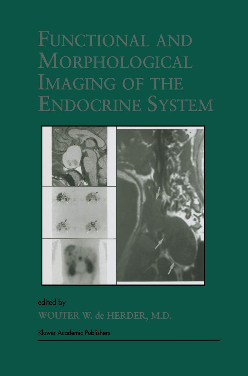 Functional and Morphological Imaging of the Endocrine System,Used
