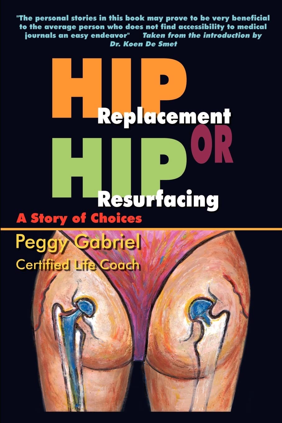 Hip Replacement or Hip Resurfacing: A Story of Choices,Used