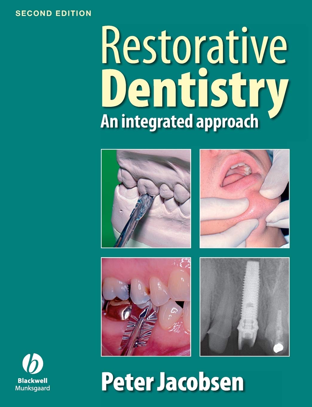 Restorative Dentistry: An Integrated Approach,Used
