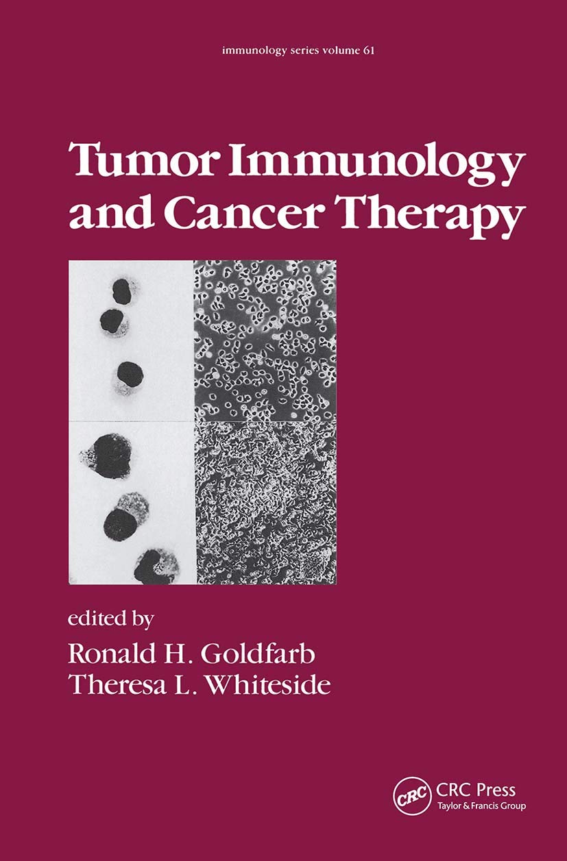 Tumor Immunology and Cancer Therapy,Used