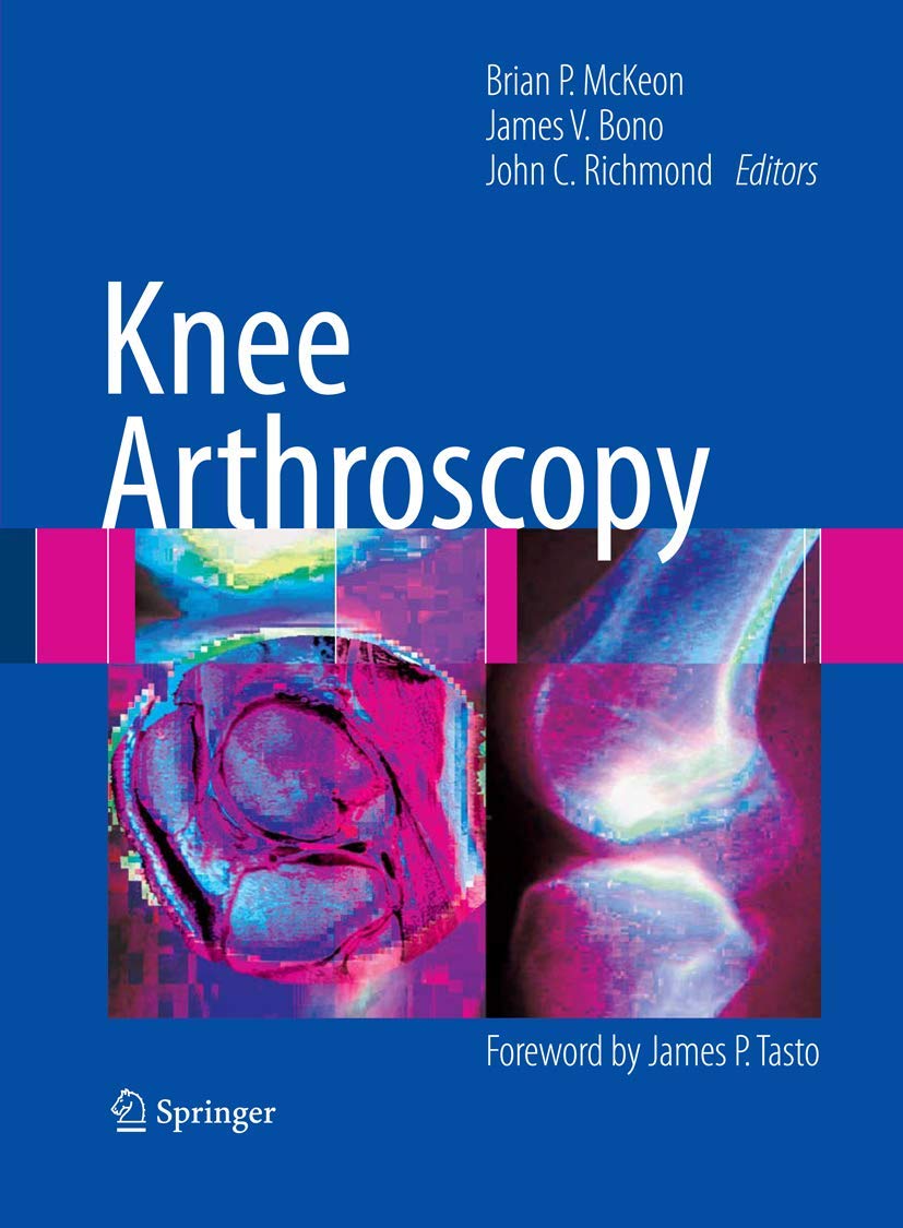 Knee Arthroscopy,Used