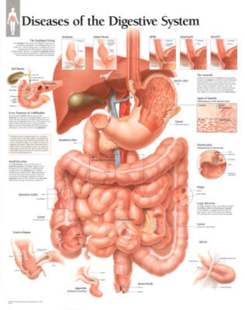 Diseases Of Digestive System Chart: Laminated Wall Chart,Used