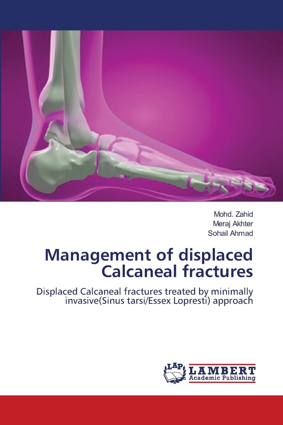 Management of displaced Calcaneal fractures: Displaced Calcaneal fractures treated by minimally invasive(Sinus tarsi/Essex Lopre,Used
