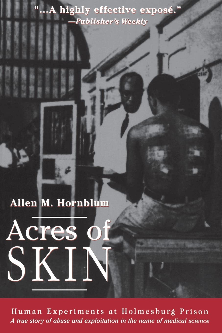 Acres Of Skin: Human Experiments At Holmesburg Prison,New