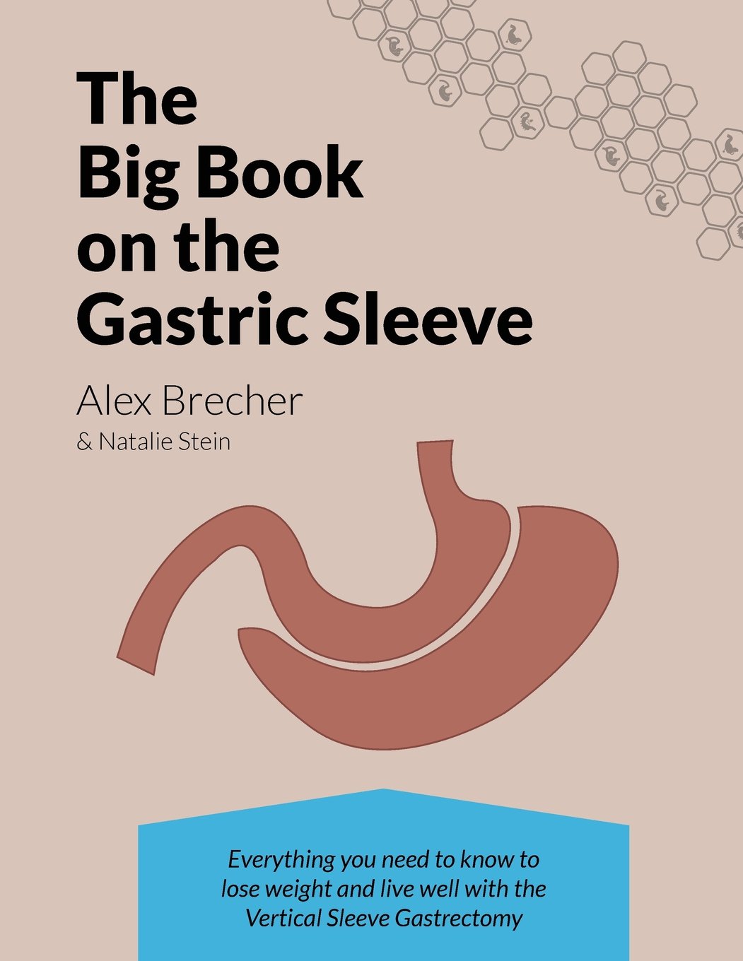 The BIG Book on the Gastric Sleeve: Everything You Need To Know To Lose Weight and Live Well with the Vertical Sleeve Gastrectom,Used